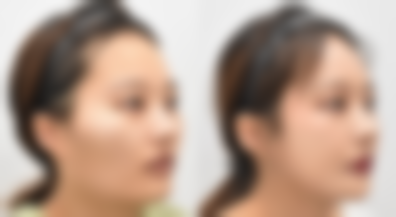 八、成都市第二人民医院整形美容科真实的顾客评价如下：