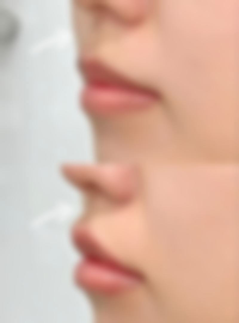 五、西安漾颜一美整形医院怎么预约：