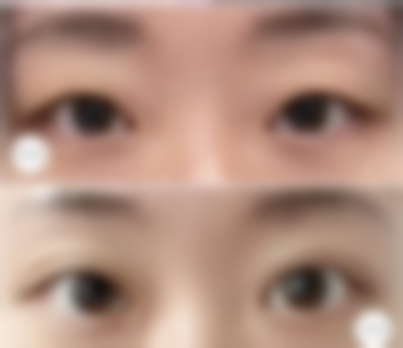 六、合肥市第一人民医院滨湖院区(烧伤整形科)价格表：（仅供参考）