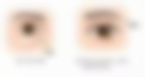 六、北京赫本私妃医疗美容门诊部怎么预约：