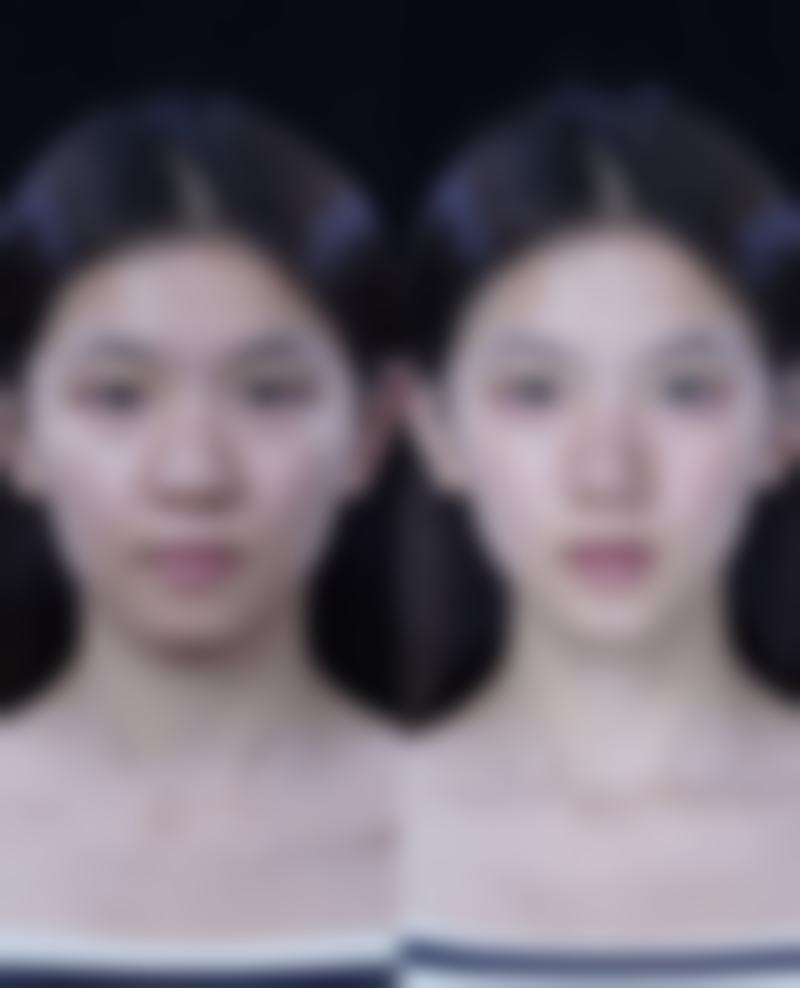 郭阿敏怎么预约？