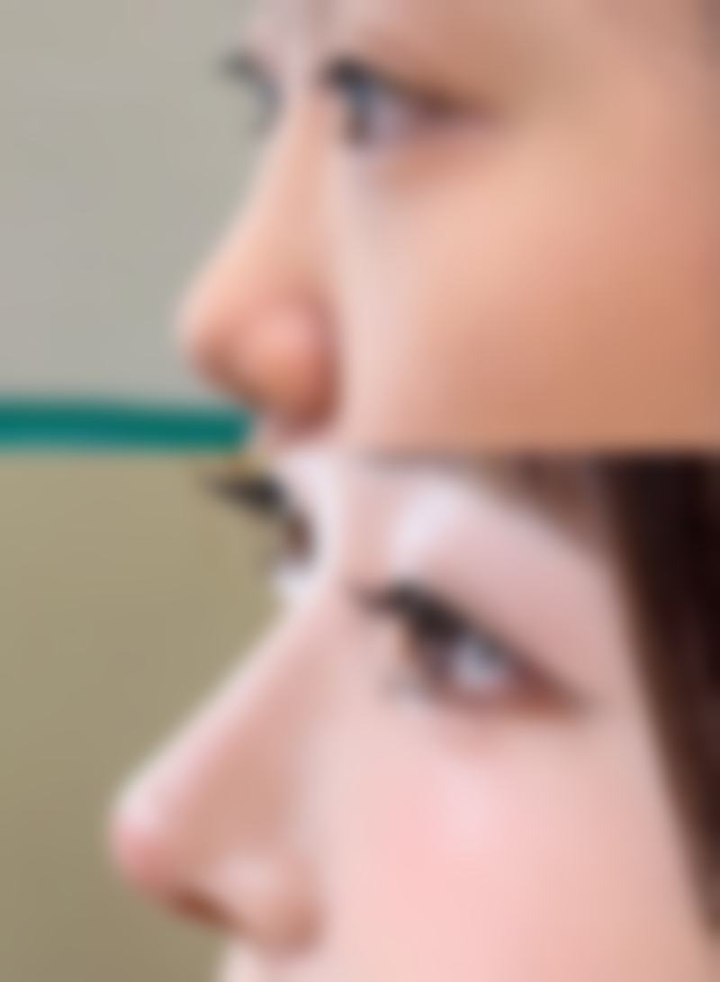 四、湛江玛丽亚医疗美容门诊部实例