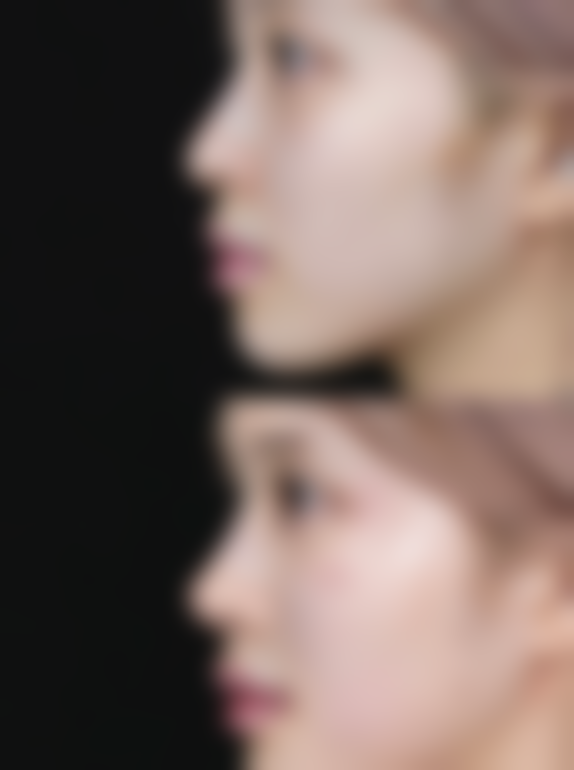 七、连云港东海珞典医疗美容门诊部价格表：（仅供参考）