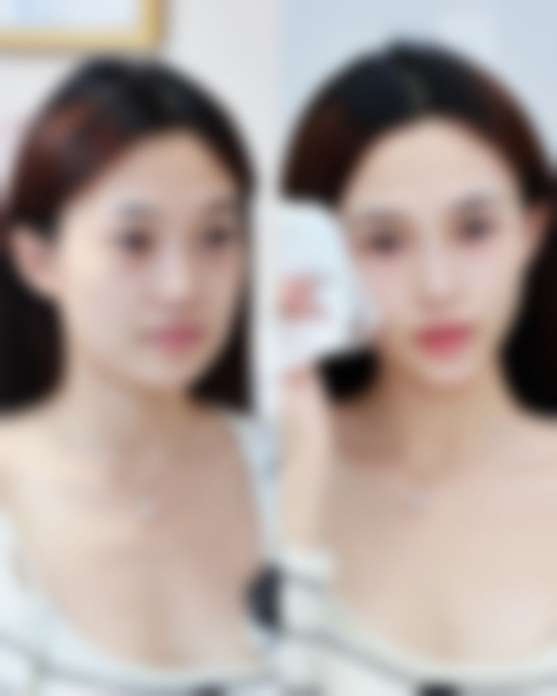 四、成都蜀尚蓉雅美容整形实例