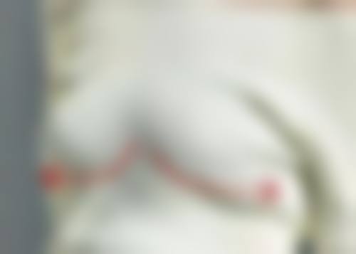 七、广州市番禺区南粤医院私密整形科真实的顾客评价如下：