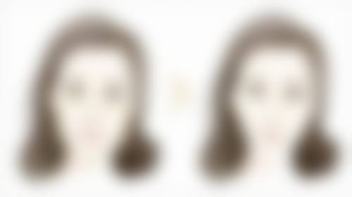 七、韩国NOTE整形外科价格表：（仅供参考）