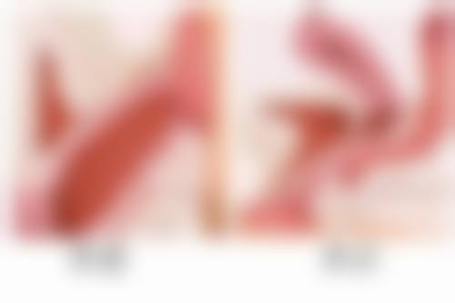 六、广州市番禺区南粤医院私密整形科价格表：（仅供参考）