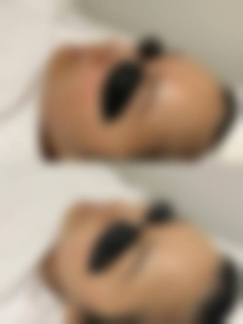 李涵羽项目价格表参考