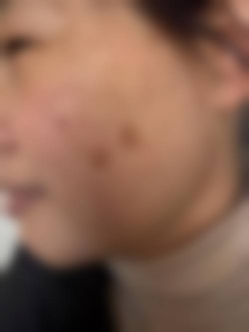 李涵羽在哪家医院