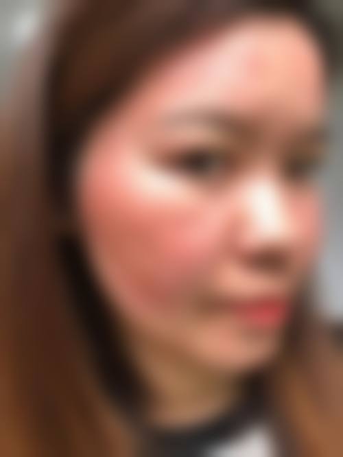 李涵羽光电美容水平怎么样可靠吗？