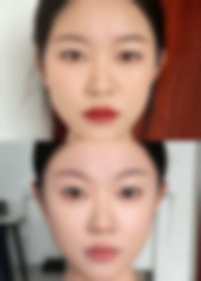 六、东莞新安医院医学整形科价格表：（仅供参考）