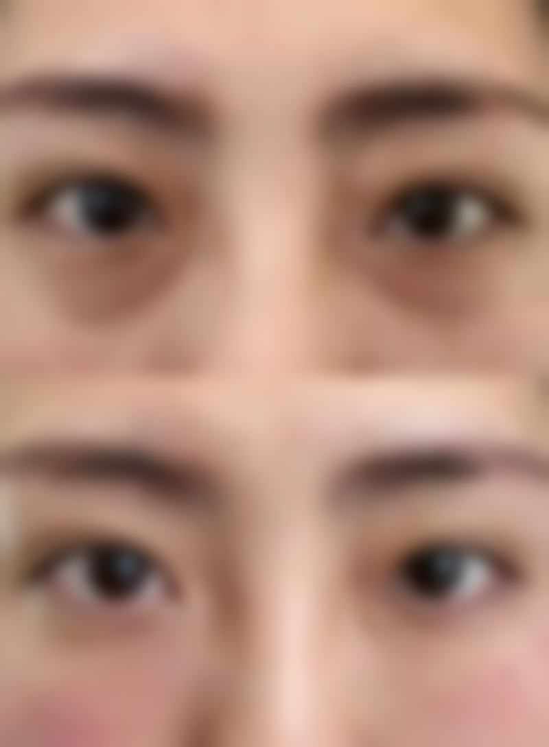 六、广州凯美达整形医院价格表：（仅供参考）