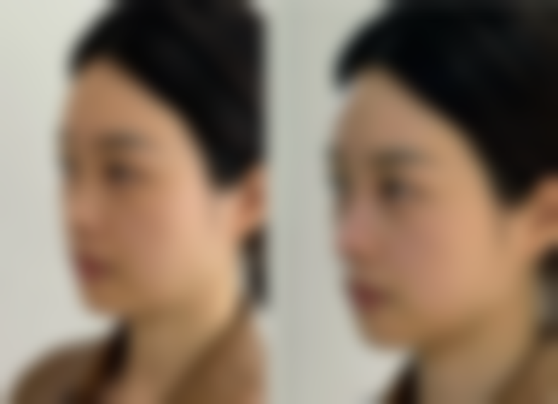 六、ewha皮肤科价格表：（仅供参考）