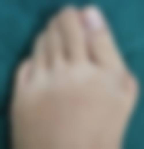 六、韩国金亨珍纽莱茵整形医院怎么预约：