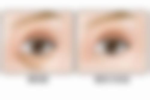 六、维西悦美整形医院价格表：（仅供参考）