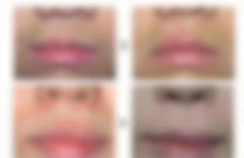 二、维西悦美整形医院正规吗？来看看医院资质：