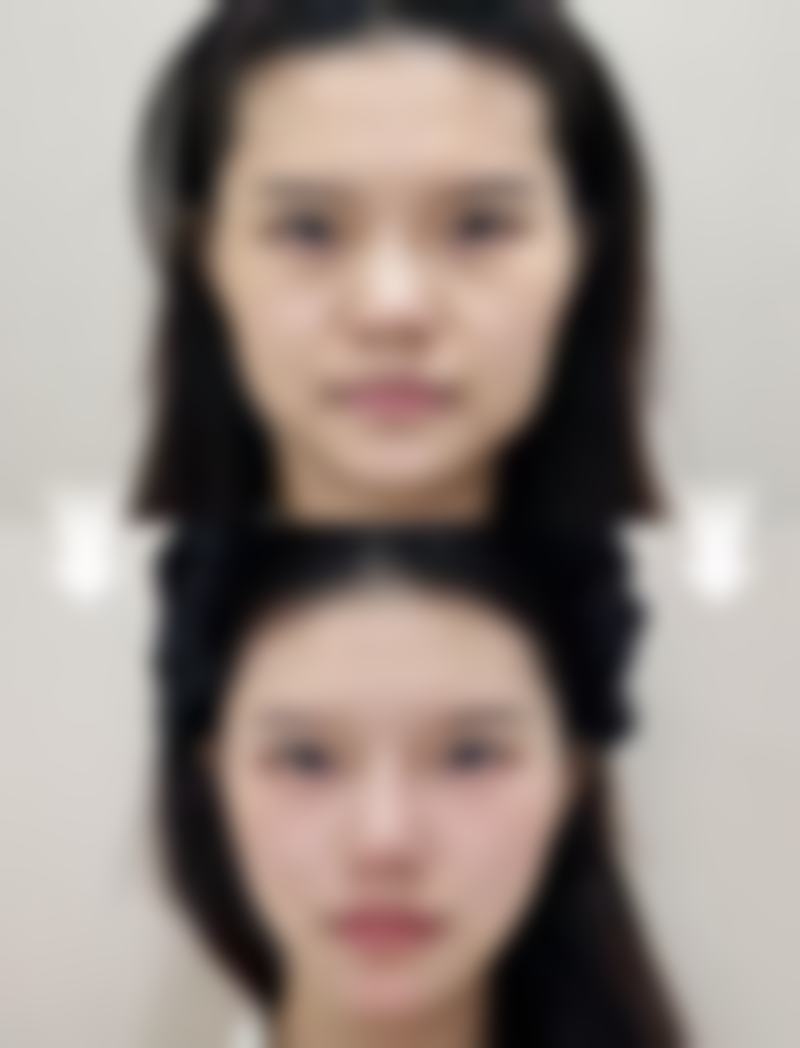 六、重庆美丽部落韵城医疗美容诊所怎么预约：