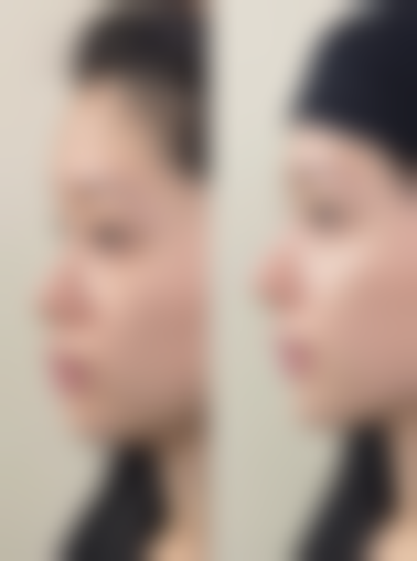 五、遵义泊美雅医疗美容医院怎么预约：