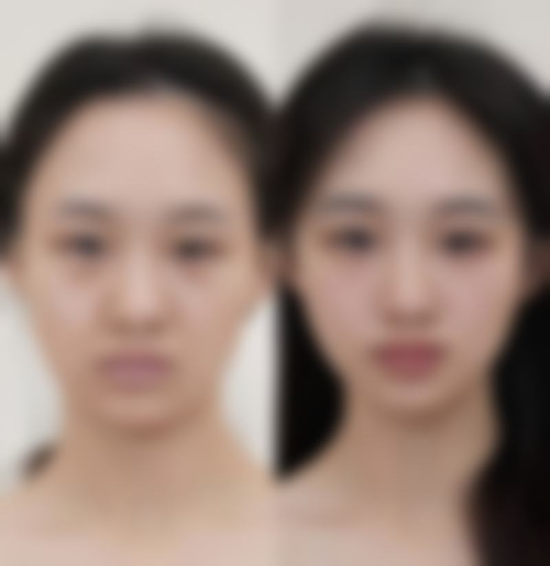 五、铜仁利美康医疗美容门诊部怎么预约：