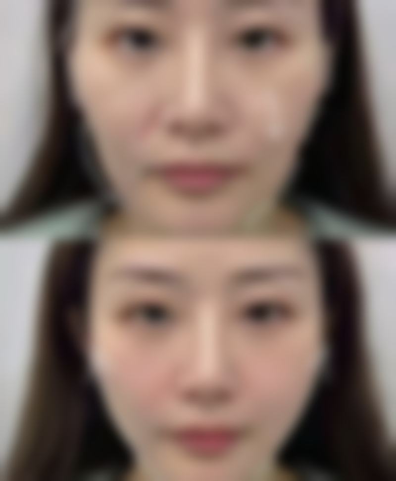 五、长沙唯姿奥拉克整形医疗美容门诊部怎么预约：