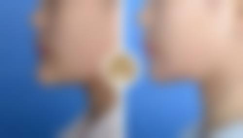 六、昆山艺航医疗医疗美容门诊部价格表：（仅供参考）