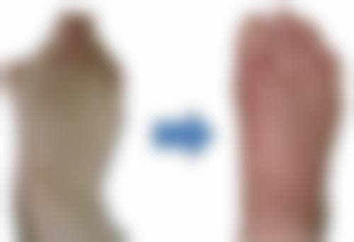 不开刀也能去眼袋？揭秘先进技术，还能紧致肌肤、淡化黑眼圈实现眼部年轻化