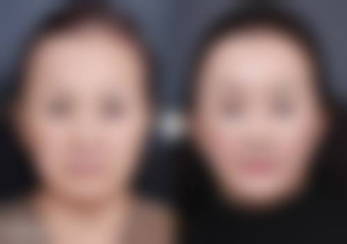 五、温岭美艺美星整形中 心实例