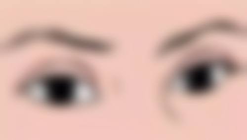 疤痕疙瘩难以自行消退？了解专业治疗方案，助你改善疙瘩外观与症状 