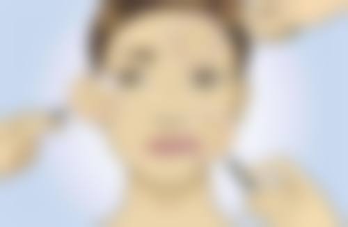 隆胸手术修复秘诀：加快回归正常生活