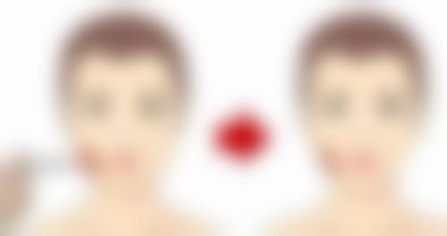 四、深圳市宝安人民医院整形外科实例