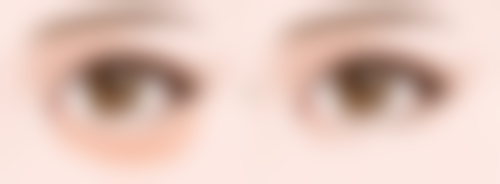 想睡出双眼皮？轻医美方案来助力