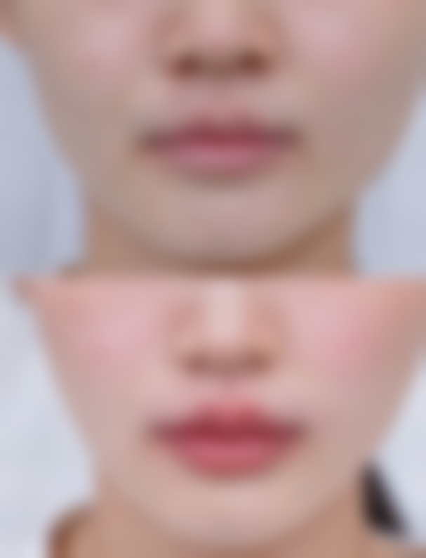 五、哈尔滨紫曦整形医院怎么预约：