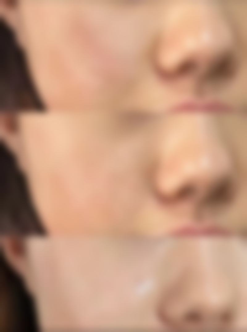 不同隆胸方式的持久度对比