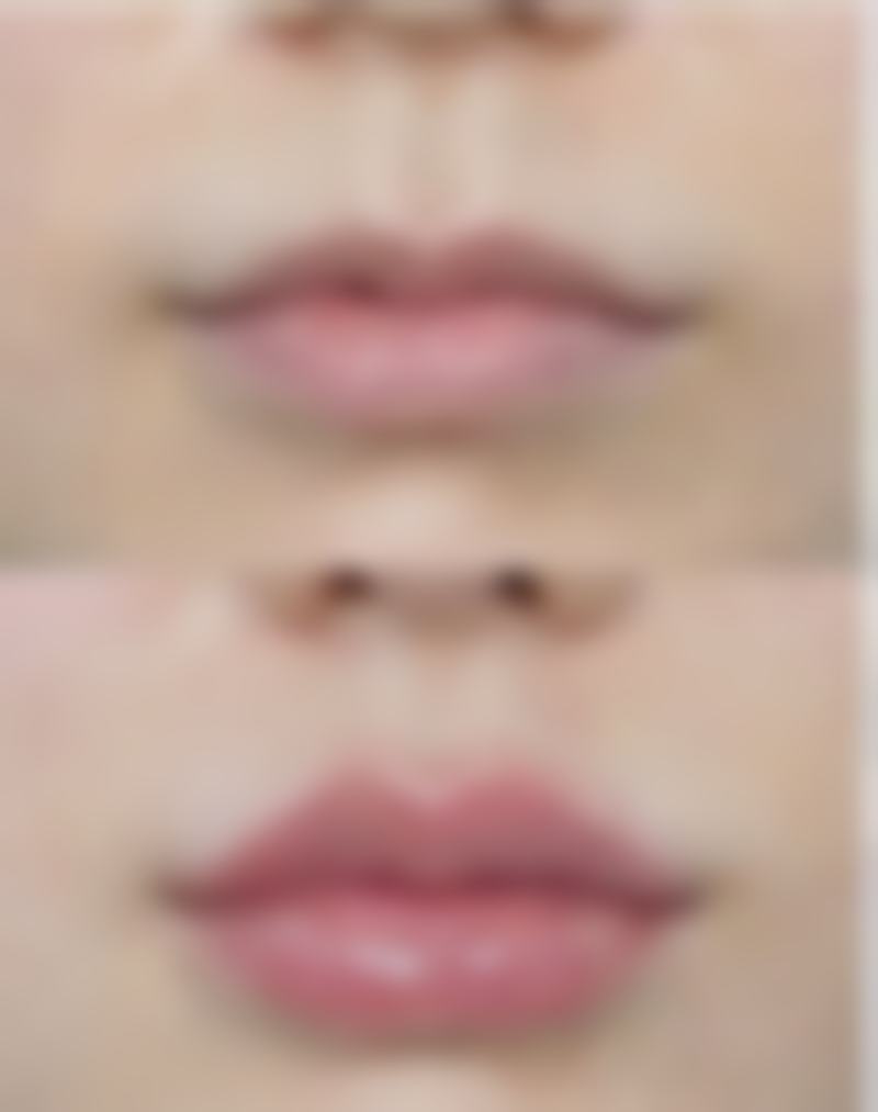 七、温岭美艺美星整形中 心价格表：（仅供参考）