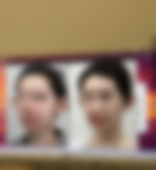 2024热门性价比隆胸假体品牌优势展现