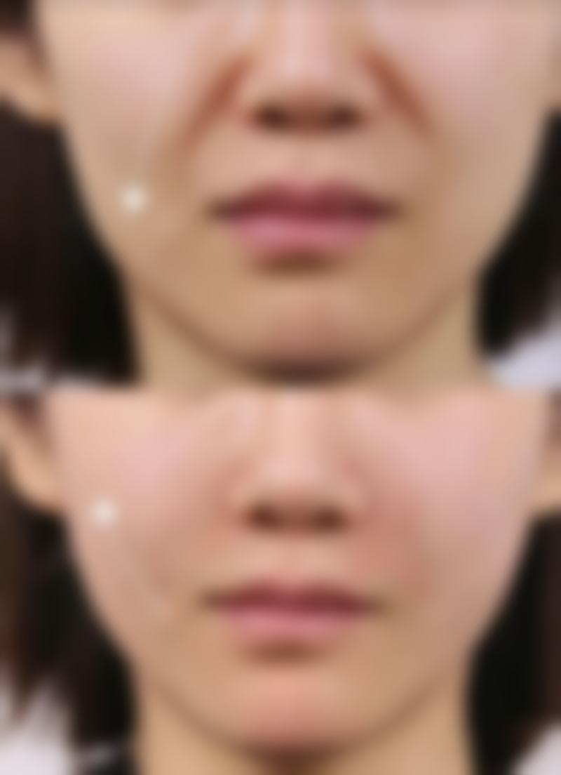 八、温岭美艺美星整形中 心真实的顾客评价如下：