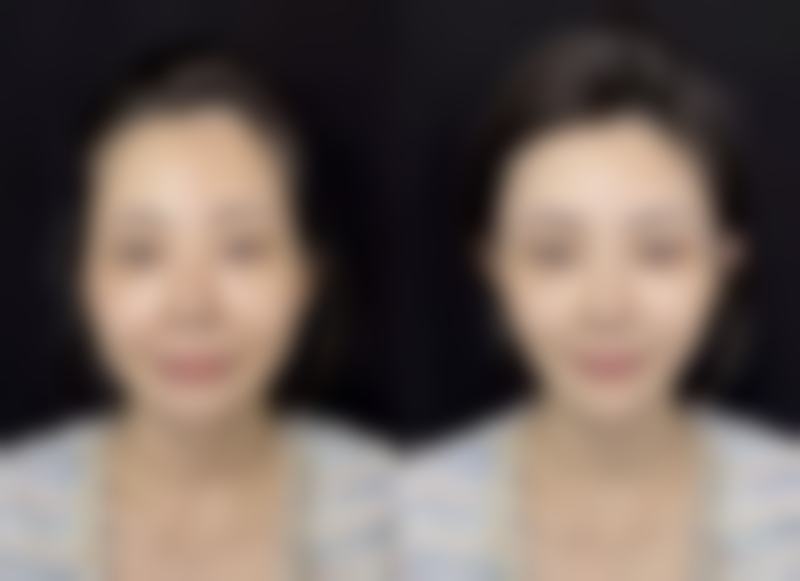 二、荆门市余克锋医疗美容诊所正规吗？来看看医院资质：