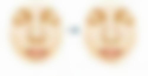 隆鼻山根高别愁！多种修复方案助你重塑自然美鼻，兼顾面部协调比例 