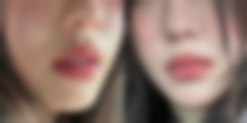 八、青岛瑧妍美医疗美容医院真实的顾客评价如下：