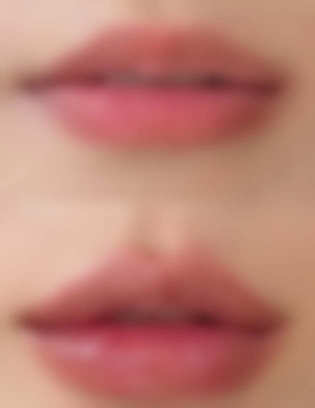 祛疤的耐心与信心：坚持就是胜利