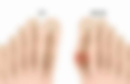 何时隆胸成效佳？不同隆胸术式的适宜时期与注意事项