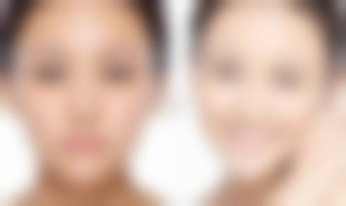 眼皮忽单忽双原因揭秘！水肿疲劳等因素作祟，多种改善方案助你稳定眼型 