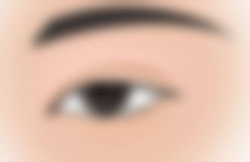 摔跤留下的疤痕如何消除？多种专业方案+优质医院助力，轻松淡化疤痕重焕肌肤光彩 