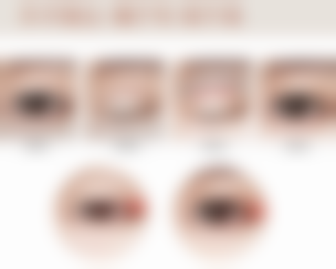 五、深圳微姿整形美容实例