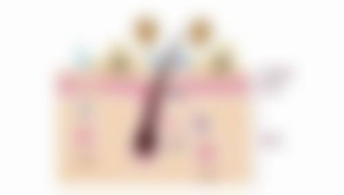 瘦脸针打完后反应大揭秘：需警惕的异常反应及处理