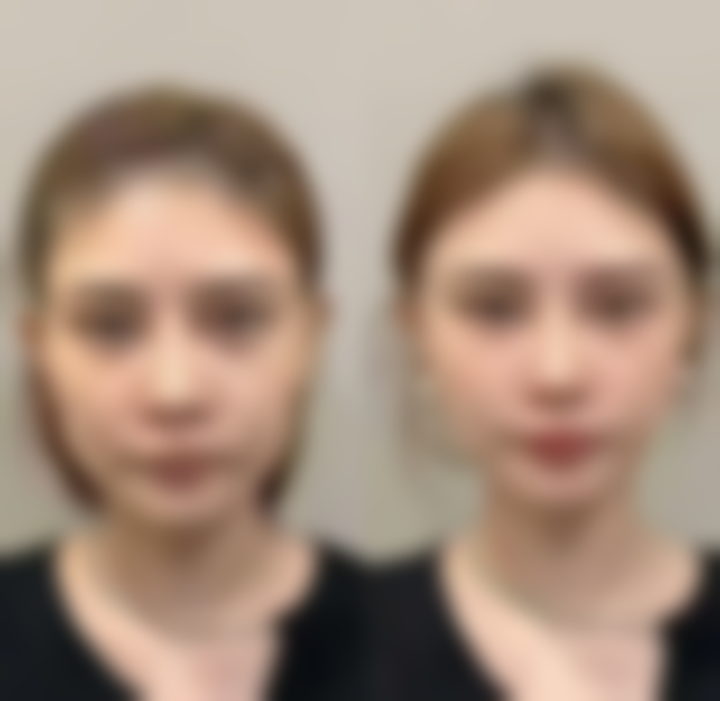 七、深圳微姿整形美容价格表：（仅供参考）