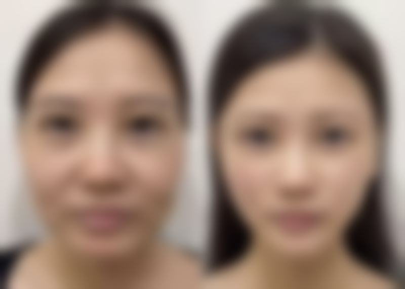 二、徐州亿星整形美容门诊部正规吗?来看看医院资质: