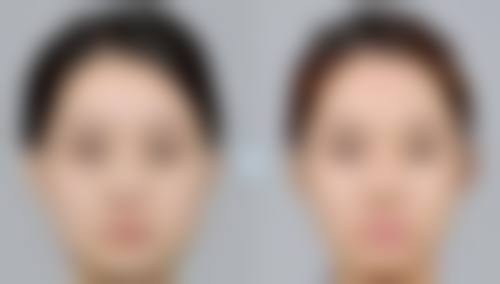 七、太原塑美美容整形门诊部价格表：（仅供参考）