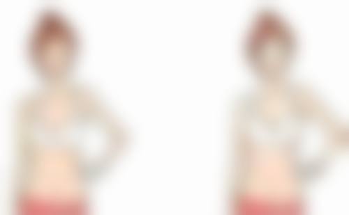 色素疤痕怎样祛掉？医疗美容显身手