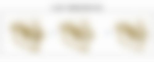 割双眼皮后多久能正常化妆？美丽需要耐心等待